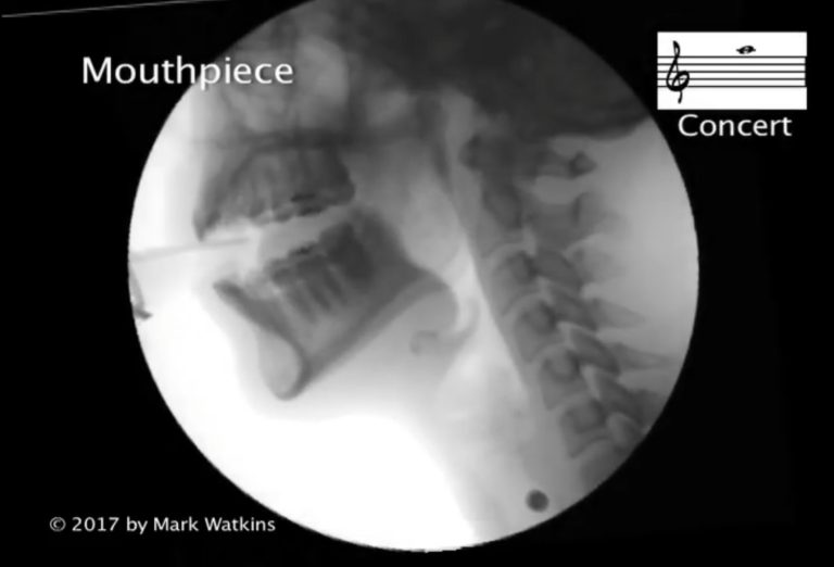 Rentgenový pohled do útrob ústní dutiny při hře na saxofon